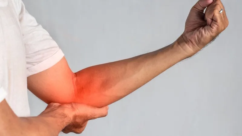 Không duỗi thẳng tay được sau khi tập gym do đâu?
